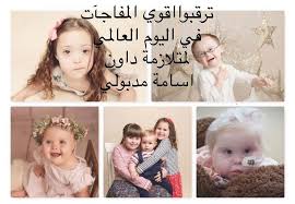 متلازمة داون On Instagram ترقبوا اقوي المفاجأت في اليوم العالمي لمتلازمة داون اسامة مدبولي Big Surprise Comingsoon About Wor In 2020 Baby Face Face Baby