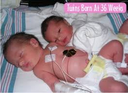 After these very critical, the earliest weeks of survival for extremely premature babies, premature survival rates rise rapidly. Preemie Twins Information And Support
