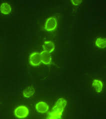Cryptosporidium causes, symptoms, prevention, treatment. Cryptosporidium Pure Water Products Llc