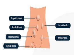 We did not find results for: Wiclhf0uswy Lm