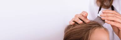 The most annoying part about getting lice is that they lay eggs called nits. Common Lice Facts Myths And Faqs Novokid