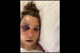 Fundraiser for Chantelle Baxter by Natasha Williams : Brandon needs your  help!