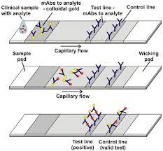 Lateral flow antigen testing involves processing a nose and throat swab sample with an lfd. Nanotechnology Startup Develops Quick Response Lateral Flow Test For Coronavirus Statnano