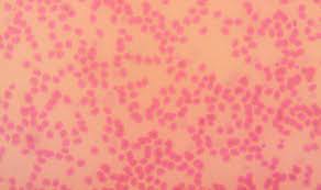 Pin On Microscopy