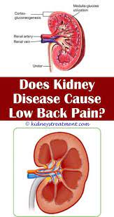 Pin On What Is Kidney Disease