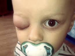 Profil Pomagacza Marek Lapinski