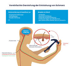 Die gehaltvolle wissensvermittlung wird mit mehr als 90 abbildungen illustriert, expertenwissen wird jedoch etwas wissenschaftlich nüchtern. Schmerzen Verstehen Und Dauerhaft Heilen Eine Befreiungsgeschichte