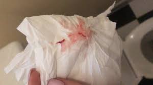 If you see a lot of blood, if the spotting lasts longer than two days, or you have any concerns, see your doctor right away. Implantation Bleeding Or Early Miscarriage