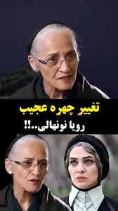 ماجرای تغییر چهره «رویا نونهالی» چیست؟