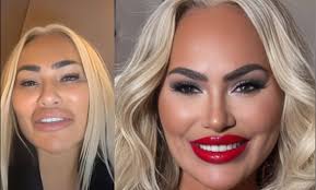 🚨🔥'90 Day Fiance' Darcey Silva Unmasks Herself In Clip, Fans Horrified‼️  ✍️👒…90 Day Fiance star Darcey Silva is known for all the cosmetic  procedures she and her twin sister, Stacey, have undergone