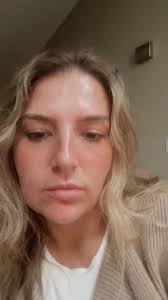 @Yenspa&massage is the best! Go book her now! #hairtok #scalpmassage  #scalptreatment #scalptreatmentcolumbusohio #selfcaretips