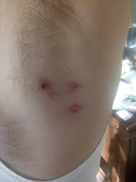 Et Beni Bitkisel Tedavi Posts Facebook