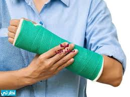 Maybe you would like to learn more about one of these? ØªÙØ³ÙŠØ± Ø­Ù„Ù… Ø±Ø¤ÙŠØ© ÙƒØ³Ø± Ø§Ù„ÙŠØ¯ ÙÙŠ Ø§Ù„Ù…Ù†Ø§Ù… Ù„Ù„Ø¹Ø²Ø¨Ø§Ø¡