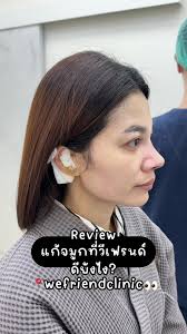 อยากหน้าละมุนขึ้น ใบหน้าสมส่วนขึ้น ตัดปีกจมูกสิคะ🤩 จากปีกจมูกกว้าง บาน  ใบหน้าไม่บาลานซ์ หลังตัดปีกจมุกหน้าเปลี่ยนทันที🥳 👉โปรแกรม #ตัดปีกจมูก กับ  #หมอเชาว์Fernclinic 👃✨ #ปีกจมูกบาน #ตัดปีกจมูกแผลใน #ปีกจมูก #ปีกจมูกกว้าง  #รีวิวตัดปีกจมูก ...