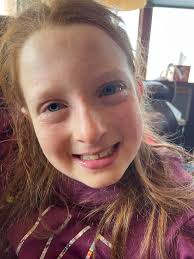 Lydia has suddenly developed bad allergies to the outdoors! I am super  frustrated- she can only be out for a short time before her eyes and face  puff up and get red