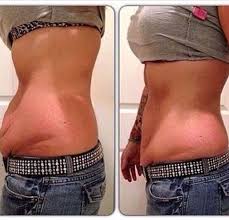 Pin On Weight Loss