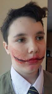 A glasgow smile (also known as an anna grin, chelsea grin or chelsea smile) is a nickname for the this site might help you. Chelsea Smile Special Effects Makeup Amino