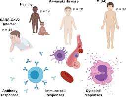 Kawasaki disease is an uncommon illness in children that causes fever, swollen lymph nodes, sore throat, rash, redness or swelling of the hands or feet, and conjunctivitis. The Immunology Of Multisystem Inflammatory Syndrome In Children With Covid 19 Medrxiv