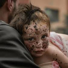 The k*lling of children continues in Gaza!