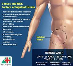 تويتر Apex Hospitals على تويتر Inguinal Hernia Is A Protrusion Of Abdominal Cavity Contents Through Inguinal Canal Symptoms Are Present In About 66 Of Affected People Https T Co N0zcezfokr