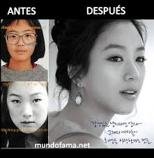 List of the hottest, most glamorous and beautiful actresses from korea. Korean Actress Before And After Plastic Surgery Actrices C Flickr