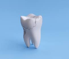 نتیجه جستجوی لغت [dent] در گوگل