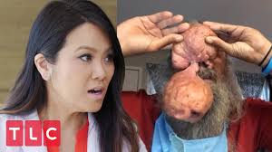 Board certified dermatologist aka as dr pimple popper on youtube and social media, tv show on tlc network. Man Has Enormous Nodules On His Nose Dr Pimple Popper Before The Pop Youtube