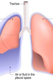 Function of lungs and lung anatomy and lung lobes. Punctured Lung Pneumothorax Symptoms Treatment And Recovery