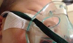 Bronchiolitis Gezondheid Be