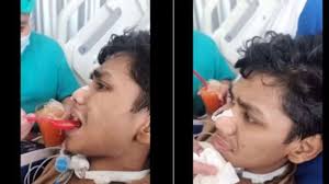 Dianiaya Mario Dandy, Mata David Ozora Sudah Lebih Fokus Usai Dirawat  Sebulan Lebih di ICU