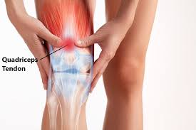 Common Knee Injuries My Family Physio