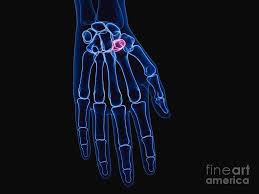 Image result for Trapezoid Bone