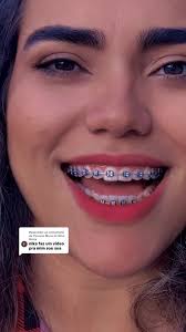 Silva Goiabeira Dubladora