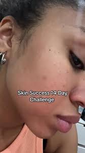 my staple skincare product!! transformed my skin!!"