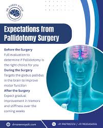 Image result for Pallidotomy