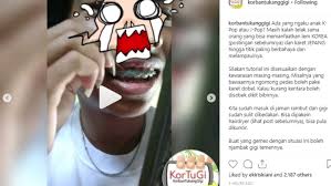 Maybe you would like to learn more about one of these? Makin Menjadi Praktik Pemasangan Behel Pakai Lem Korea Dibongkar Habis Akun Korbantukanggigi