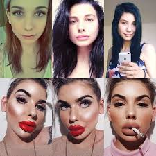 As you can see they have become more arched and elevated than before. 19 People Who Took Plastic Surgery Too Far In 2021 Plastic Surgery Gone Wrong Bad Plastic Surgeries Plastic Surgery Photos