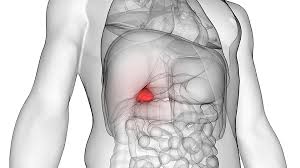 De ani sufar de probleme cu fierea (am fierea strangulata ), s. AfecÈ›iuni Biliare InsoÈ›ite De Durere AbdominalÄƒ Aceste Sfaturi IÈ›i Vor Face ViaÈ›a Mai BunÄƒ