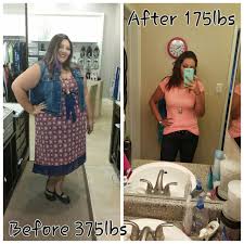 Pin On Before And After