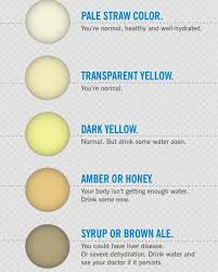 Baby Pee Color Chart Pictures Of Normal Baby Poop Breastfed