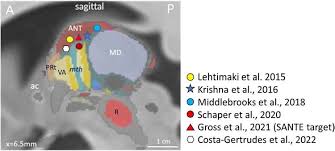 Image result for Magnetic 2020 Responder