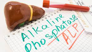 Gesundheitslexikon Alkalische Phosphatase