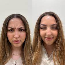 Anna Cope RN, BSN (@annarn.skinriched) · Instagram 照片和视频