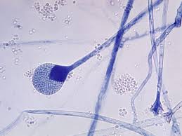 Bronchopneumonia bacteria, viruses, fungi, mycoplasma, chlamidia, chemical and physical factors after acute bronchitis and bronchiolitis. Tclfeodu G9s4m