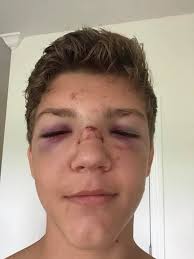 Older Methacton wrestling coach injured raking leaves