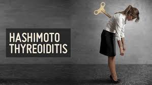 Warum Hashimoto Thyreoiditis Behandelbar Ist Paleo360 De