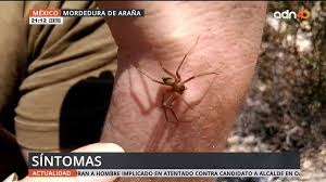 La araña reclusa parda, violinista o del rincón ( loxosceles) mide aproximadamente 0.5 pulgadas (1.3 cm) de largo y tiene el las picaduras de la araña reclusa parda no siempre duelen de inmediato. Adn40mx Mordedura De Arana Violinista Facebook