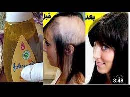 ضعيها في الشامبو لن يتوقف شعرك عن النمو بغزارة و لن يتساقط بعد اليوم ينبت الفراغات و يحارب الصلع Youtube In 2020 Skin Care Mask Skin Care Skin