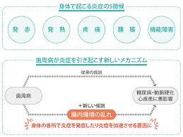 歯周病が腸に影響 口腔環境と腸内環境の関係 腸のおもしろ話 第5回 サンスター健康道場
