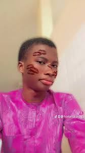 Why will this school transfer me from Botany to Medicine and Surgery 😩.  Guys is it possible to transfer back to Botany when I get to part 2 because  I don't understand